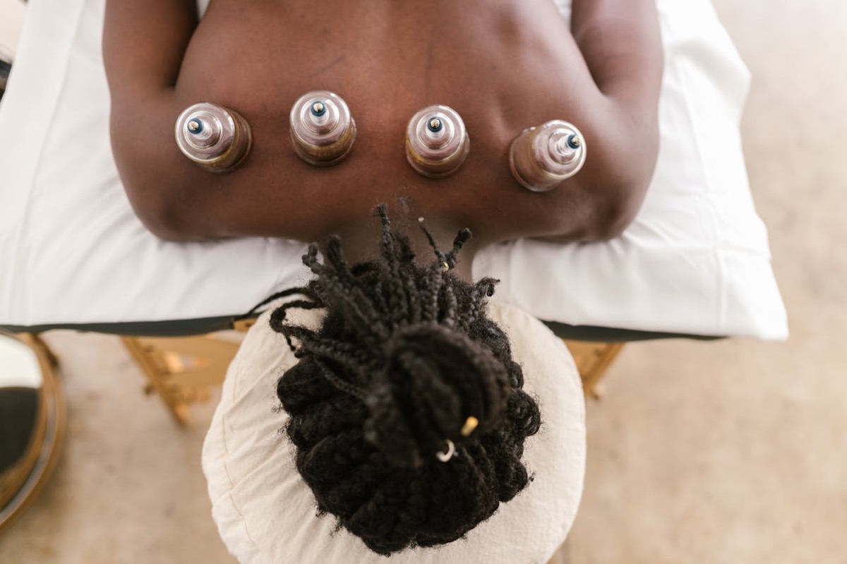 Glass cups applied to a client's back during a cupping treatment